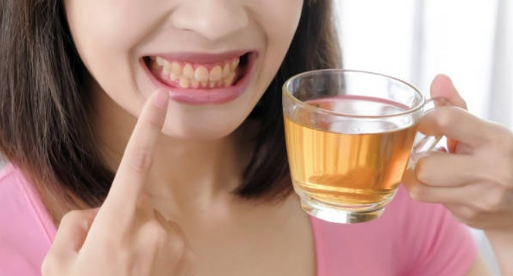 喝茶容易導致牙齒發黃