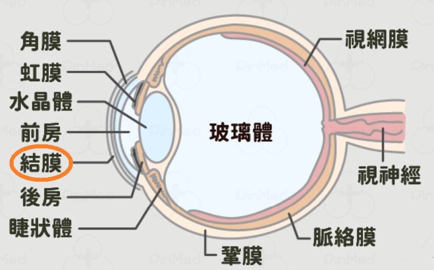 圖片是一張特別標示出結膜位置的眼球結構圖