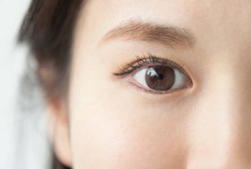 Thermage眼效果